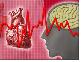 angina2