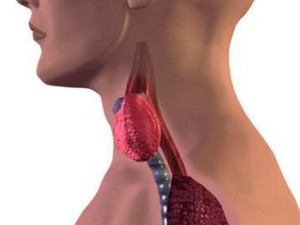 hypothyroidism
