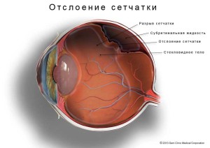 otsloenie-setchatki
